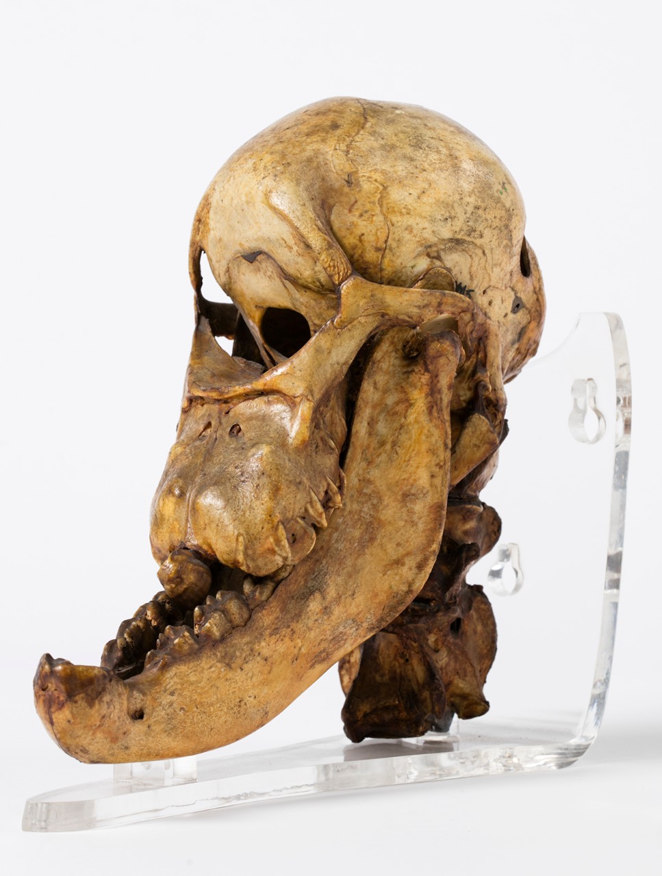 A one-eyed skull found in a river