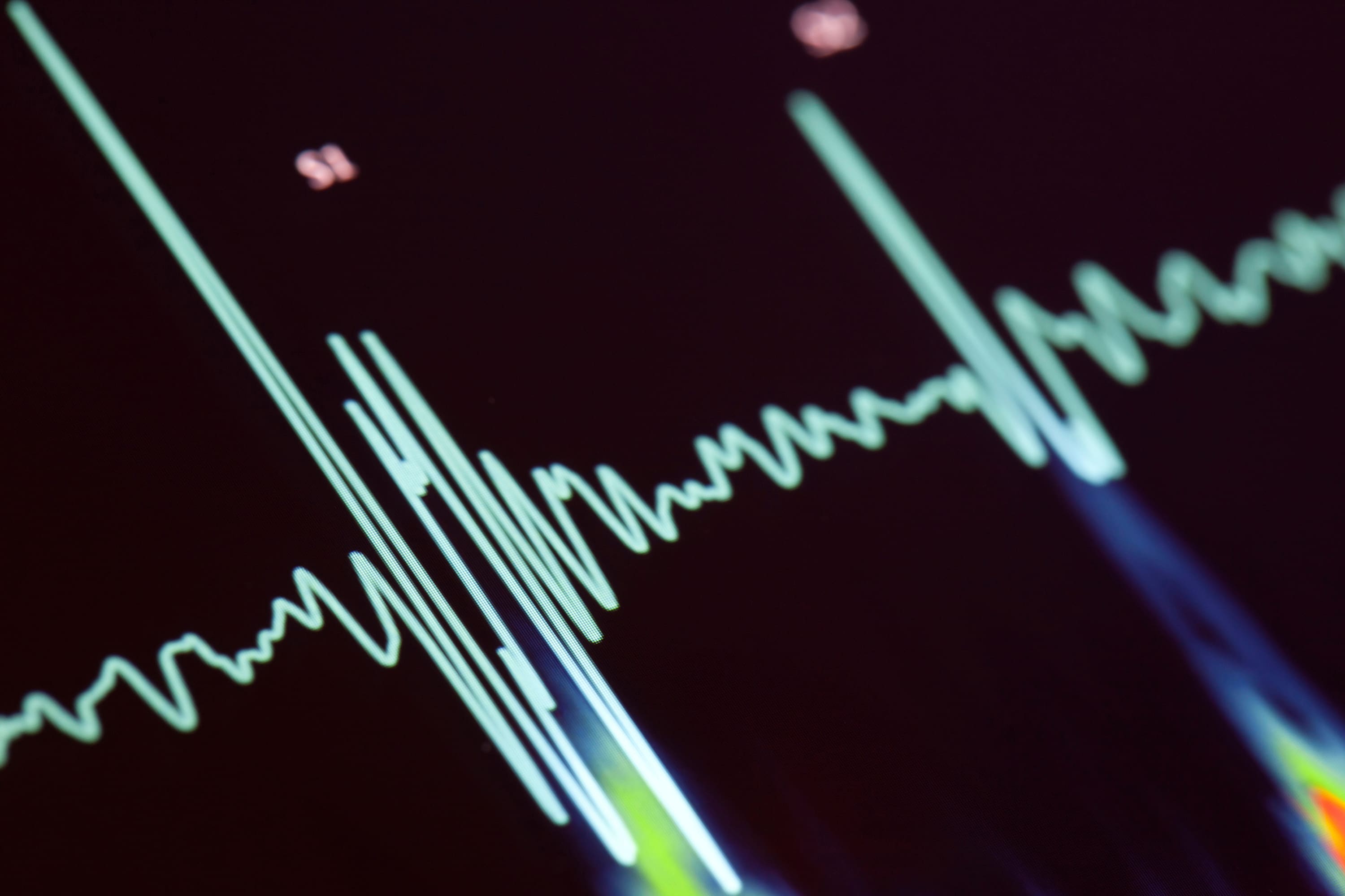 Medtech company partners with researchers to improve arrhythmia outcomes