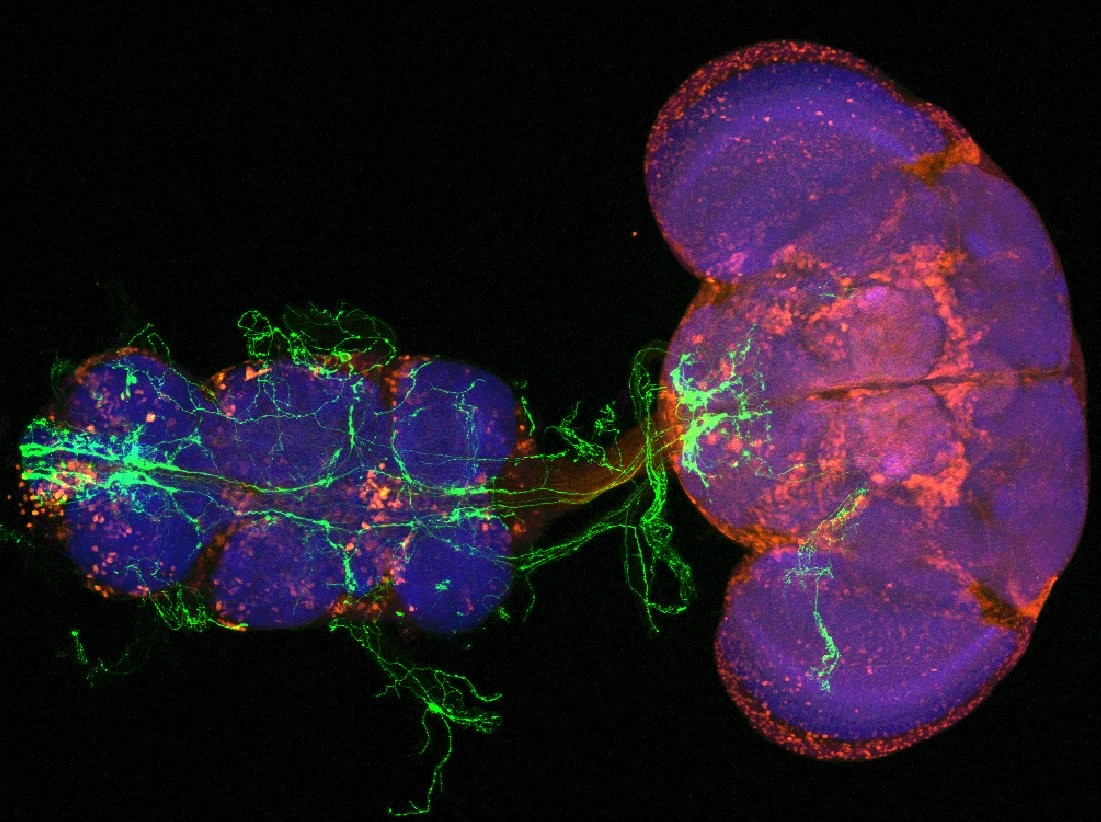 image of a fruit fly brain and ventral nerve cord