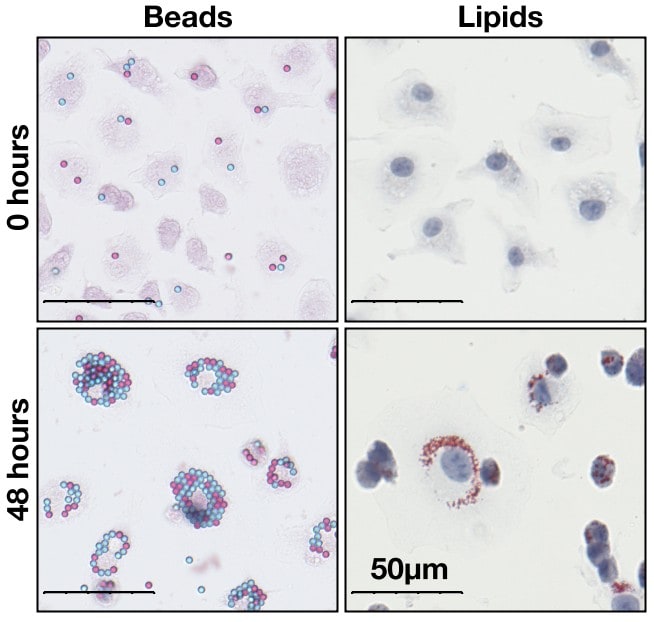 Macrophages derived from the bone marrow of mice prior to (top), and 48 hours after (bottom), stimulation into an inflammatory state. Cells were either initially fed red and blue latex microbeads (left) or were stained red for lipid (right).