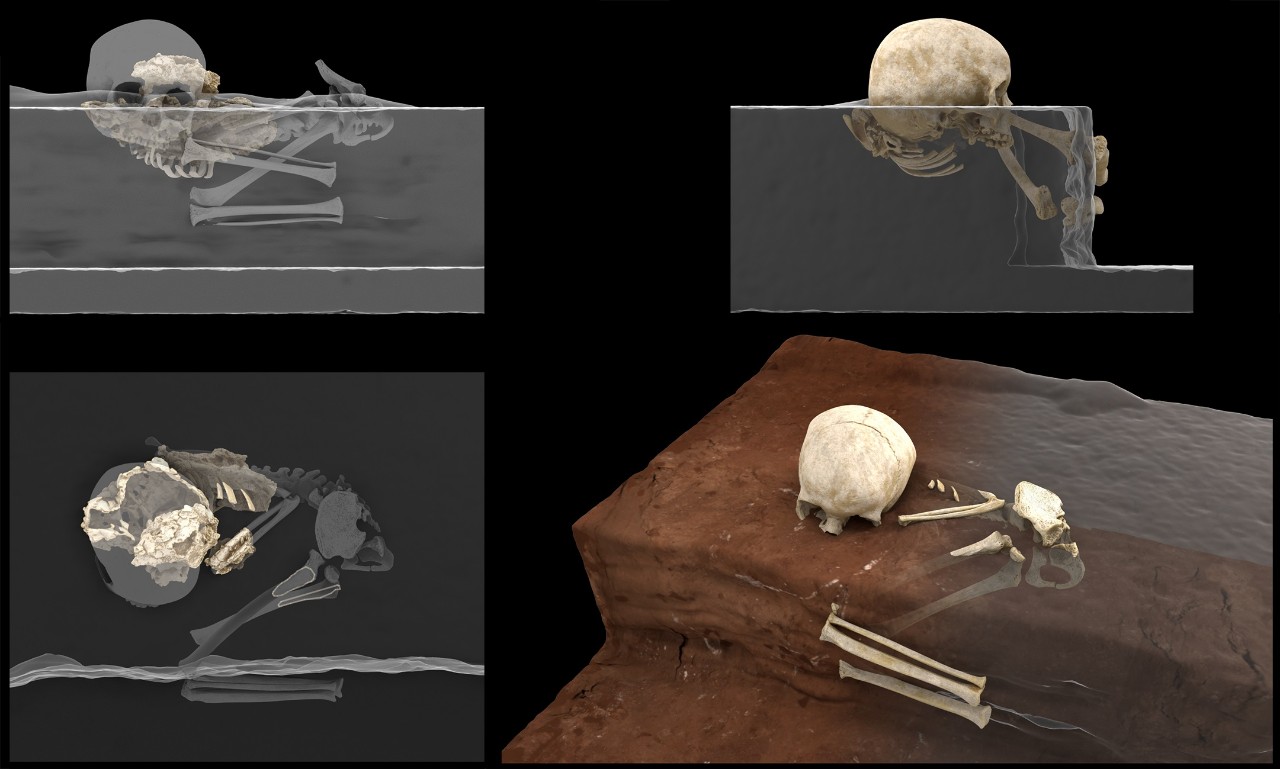 xray images of the skeleton