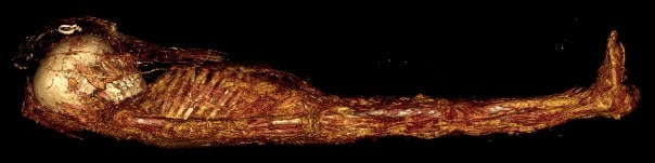 CT scan of a boy called Horus, whose body has been deliberately mummified.