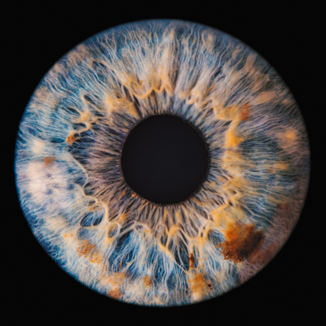 A close-up image of a human eye