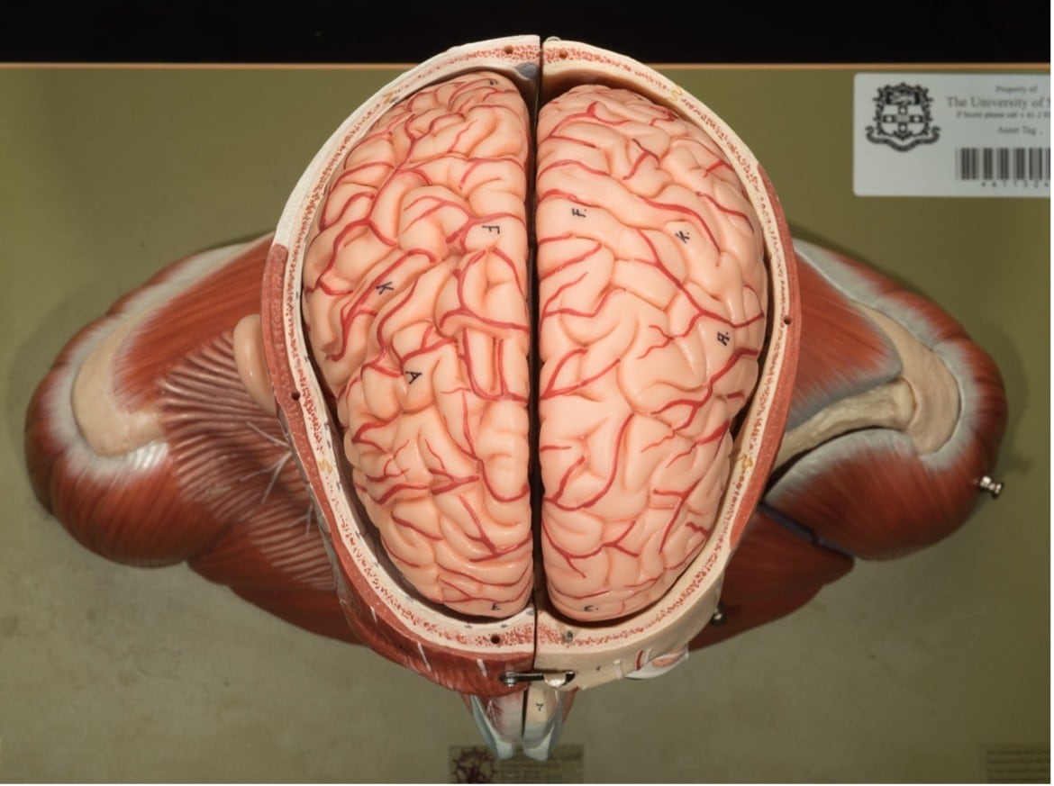 Superior view of an anatomical model revealing the cerebral cortex