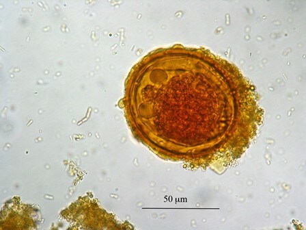 Microscopic image of dermatobia larva