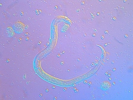 Microscopic image of third stage filariform larva