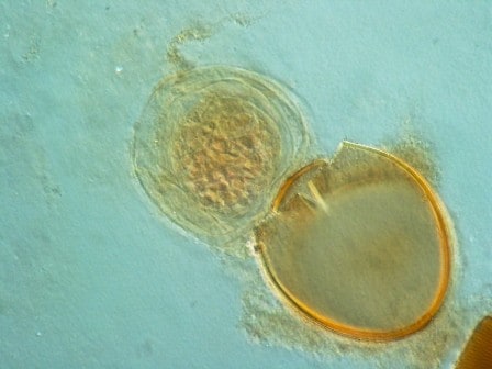 Microscopic image of coracidium released from an egg