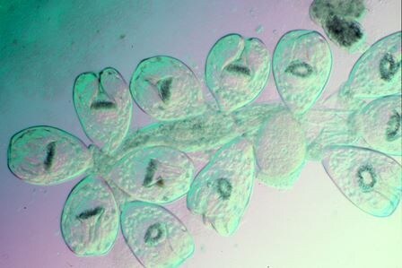 Microscopic image of hydatid cyst
