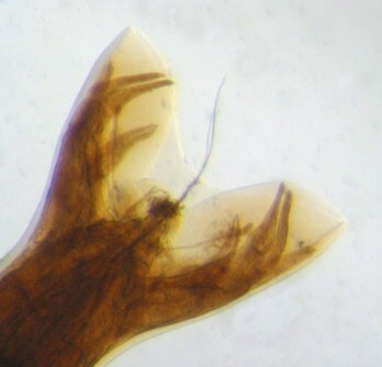 Microscopic image of adult male necator