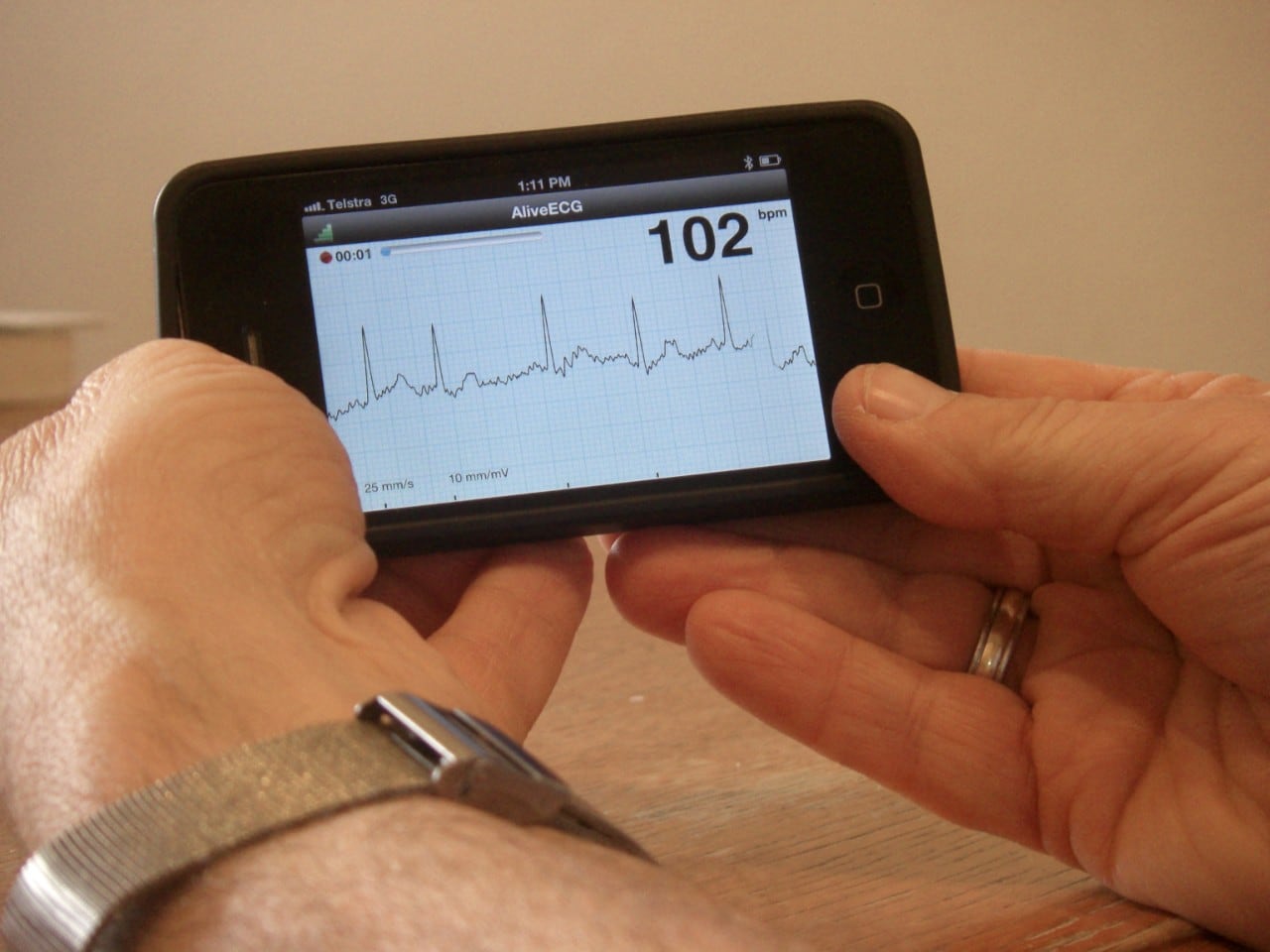 A photo of the AliveCor/Kardia Heart Monitor for smartphone (iECG).