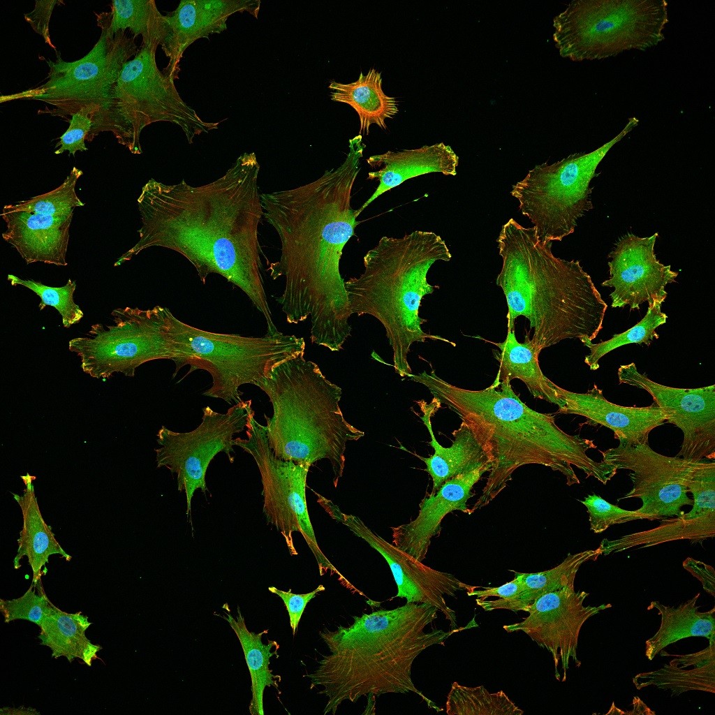 Fluorescently labelled mesenchymal stem cells growing on tropoelastin