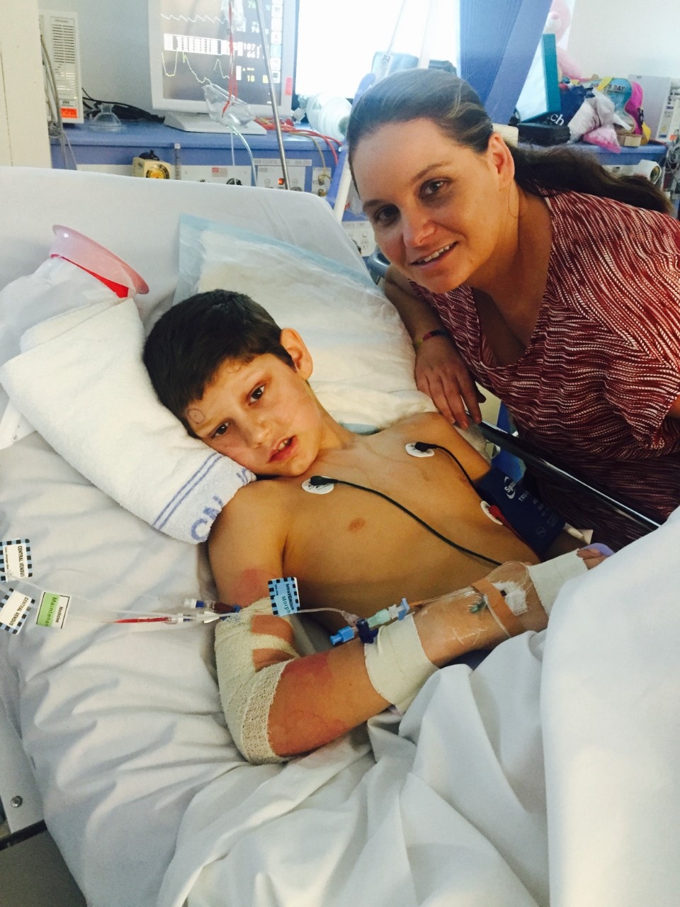 Caleb in hospital with his mother, Suzanne Turpie