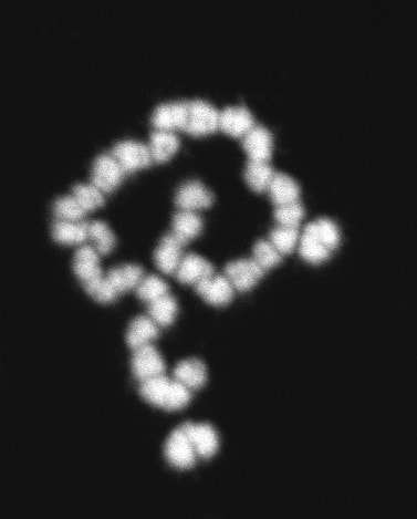 Chromosomes in the reproductive tissues of male Glyptotermes nakajimai, which have an unusually high number of Y chromosomes (15 out of 17). 