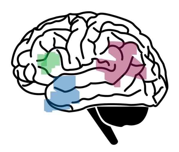 Diagram of the brain showing regions affected by aphasia