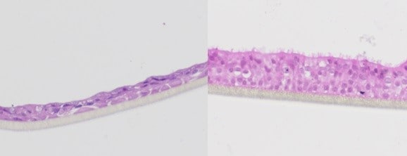 Diseased (left) and healthy (right) membrane slivers from a lung organoid [Credit: Phan et al.]