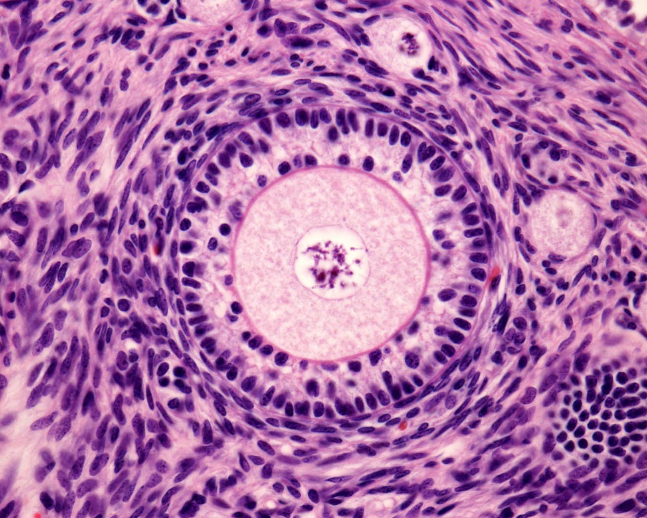 Medical image of primary ovary follicle 